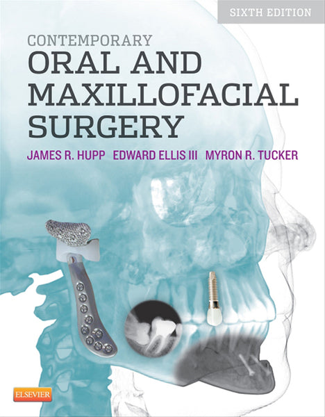 Contemporary Oral and Maxillofacial Surgery - E-Book – Van Schaik