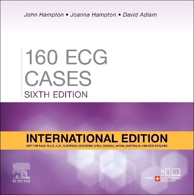 150 Ecg Cases (I/E)
