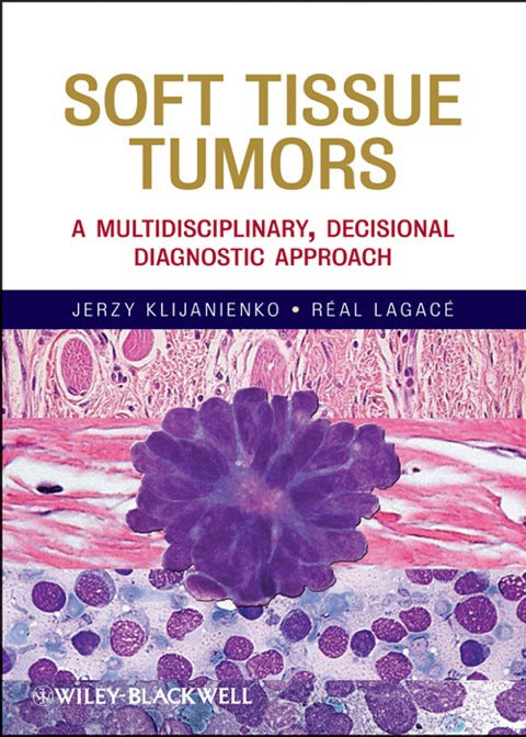 Soft Tissue Tumors a Multidisciplinary Decisional Diagnostic Approach
