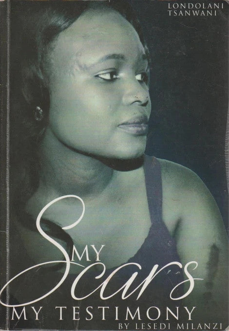My Scars My Testimony
