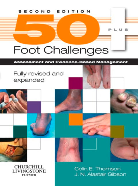 50+ Foot Challenges Assessment and Evidence Based Management