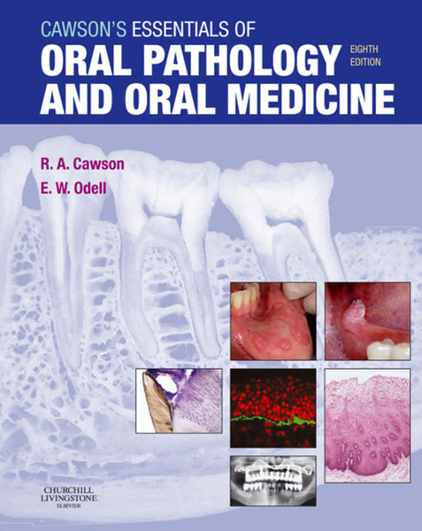 Cawsons Essentials of Oral Pathology and Oral Medicine E-Book