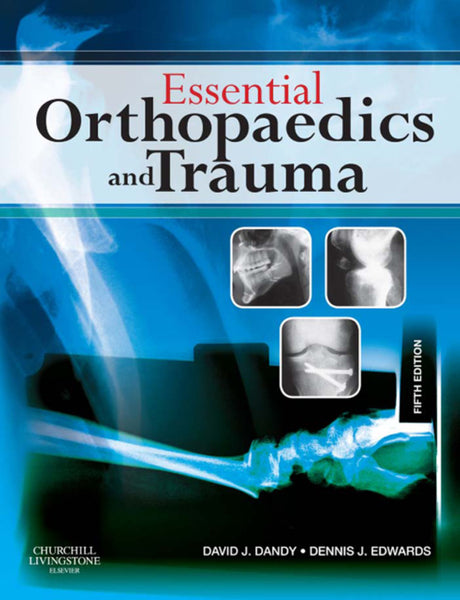 Essential Orthopaedics and Trauma E-Book