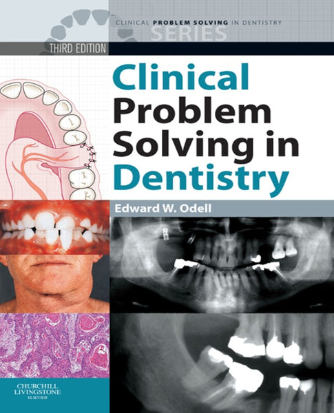 Clinical Problem Solving in Dentistry E-Book