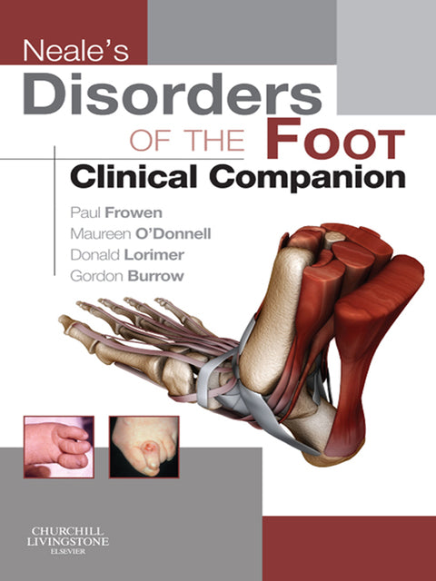 Neales Disorders of the Foot
