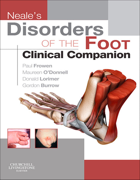 Neales Disorders of the Foot