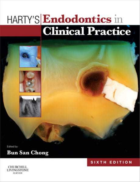 Hartys Endodontics in Clinical Practice