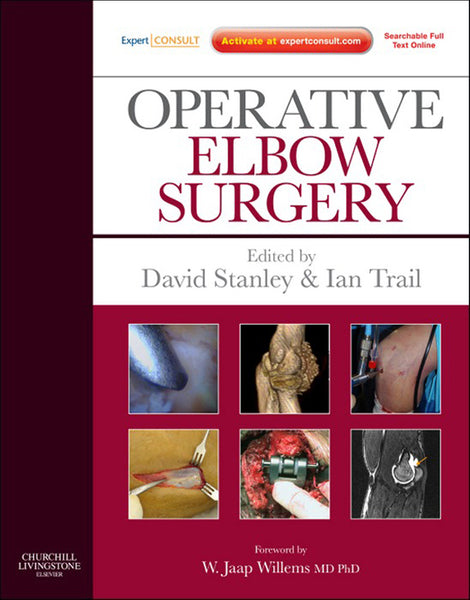 Operative Elbow Surgery (Ebook)