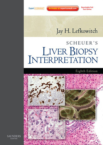 Scheuers Liver Biopsy Interpretation E-Book