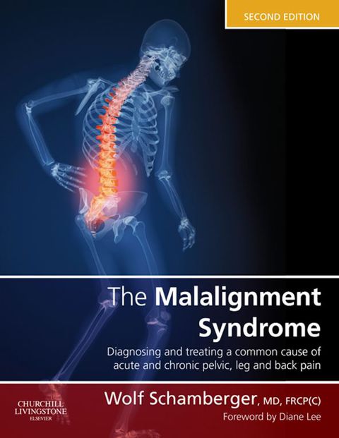Malalignment Syndrome Diagnosis and Treatment of Common Pelvic and Back Pain