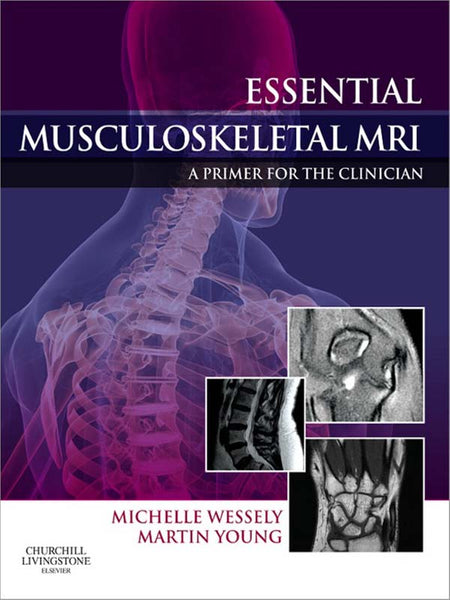 Essential Musculoskeletal Mri E-Book