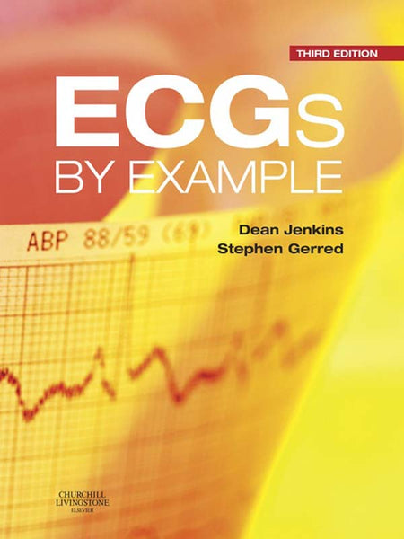 Ecgs by Example E-Book
