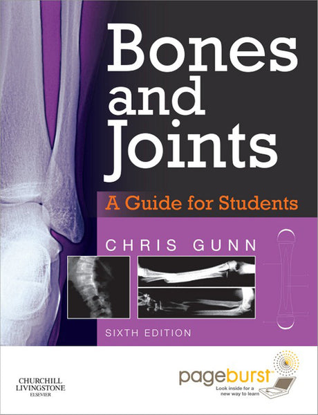 Bones and Joints - E-Book