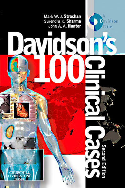 Davidsons 100 Clinical Cases E-Book