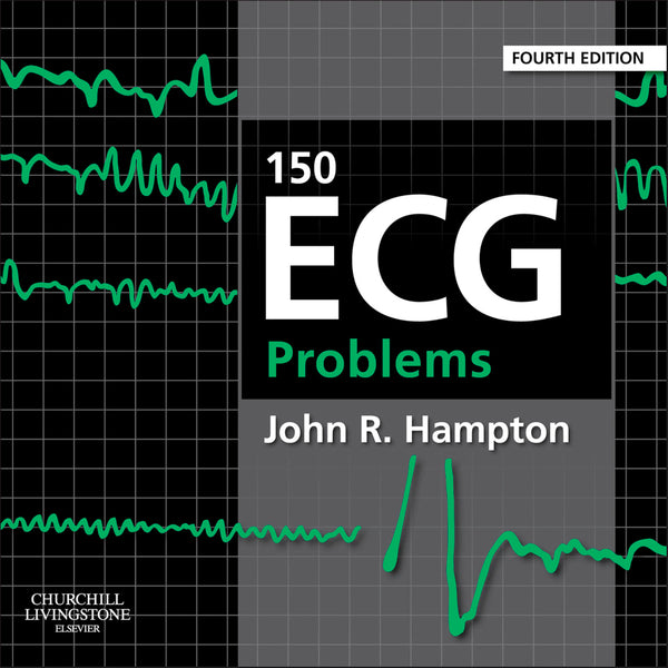150 Ecg Problems E-Book