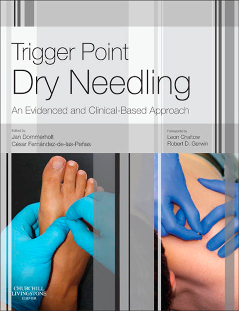 Trigger Point Dry Needling an Evidence and Clinical Based Approach
