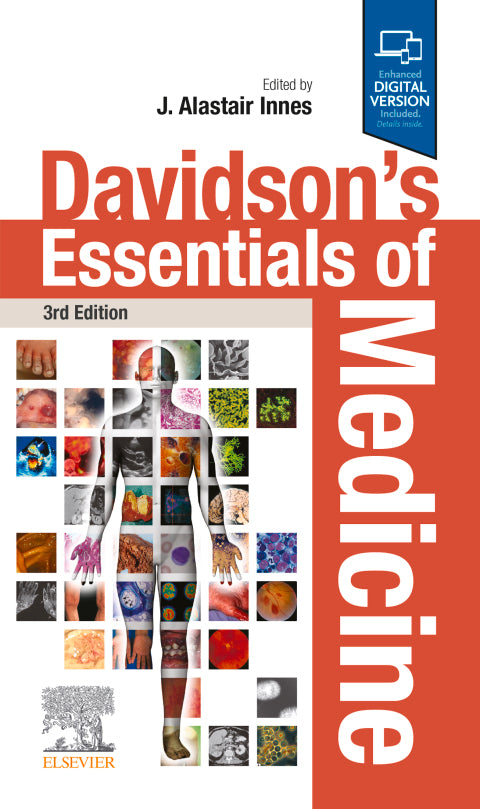 Davidsons Essentials of Medicine