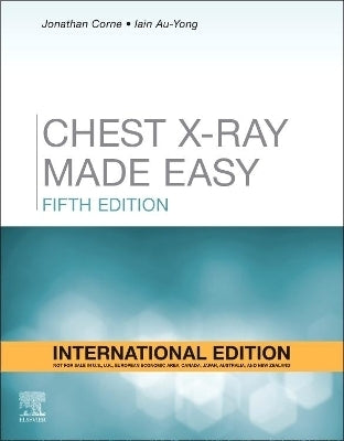 Chest X Ray Made Easy (I/E)