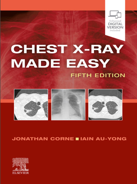 Chest X Ray Made Easy