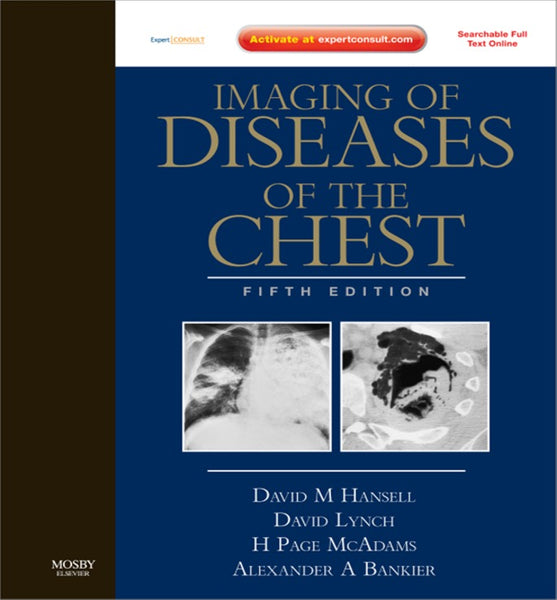 Imaging of Diseases of the Chest (Ebook)