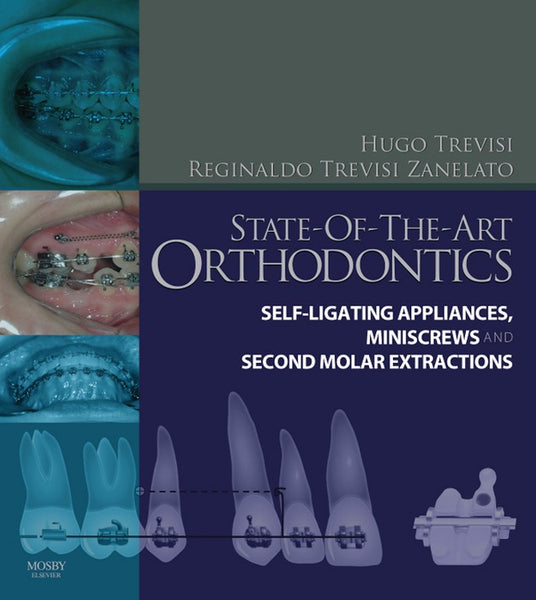 State-Of-The-Art Orthodontics E-Book