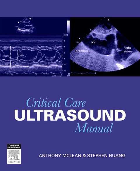 Critical Care Ultrasound Manual