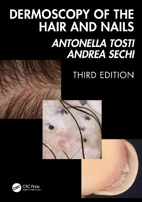 Dermoscopy of the Hair and Nails (H/C)