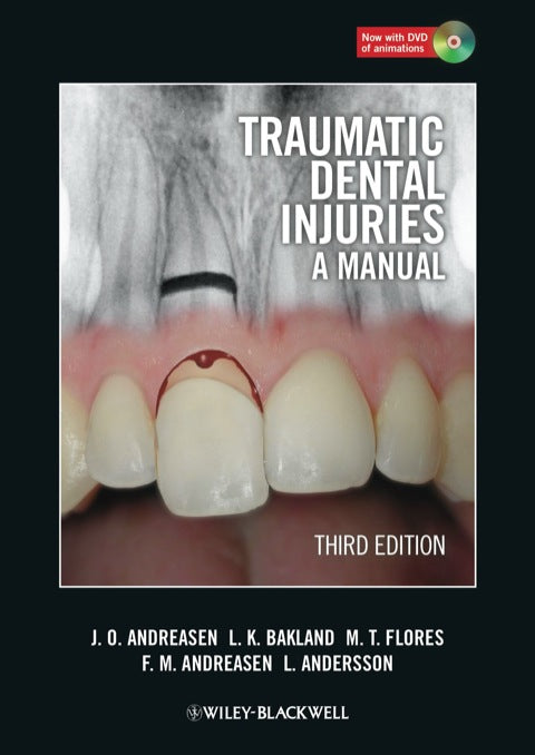 Traumatic Dental Injuries a Manual