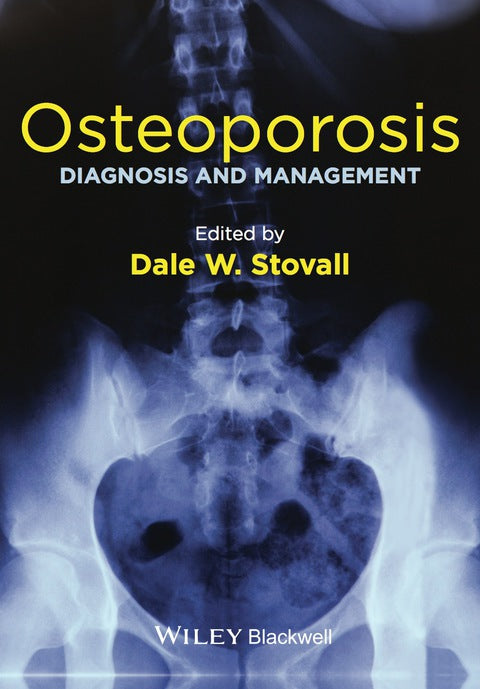 Osteoporosis Diagnosis and Management