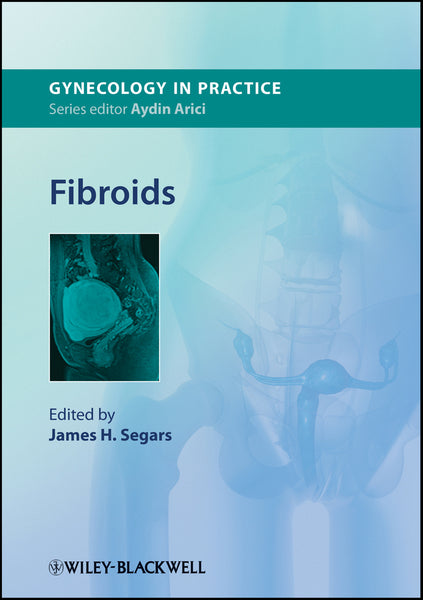 Fibroids