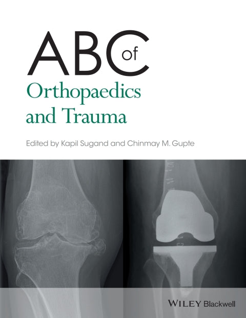 Abc of Orthopaedics and Trauma