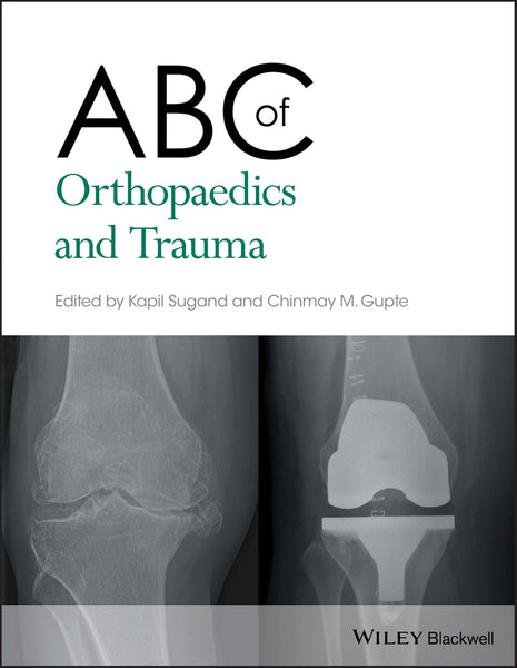 Abc of Orthopaedics and Trauma