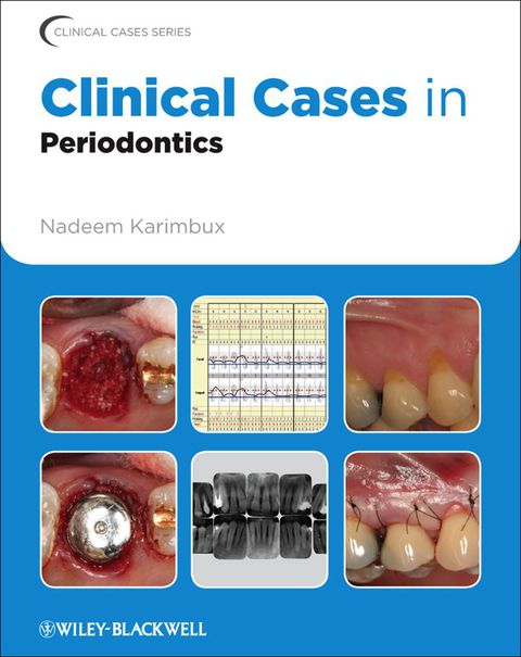 Clinical Cases in Periodontics