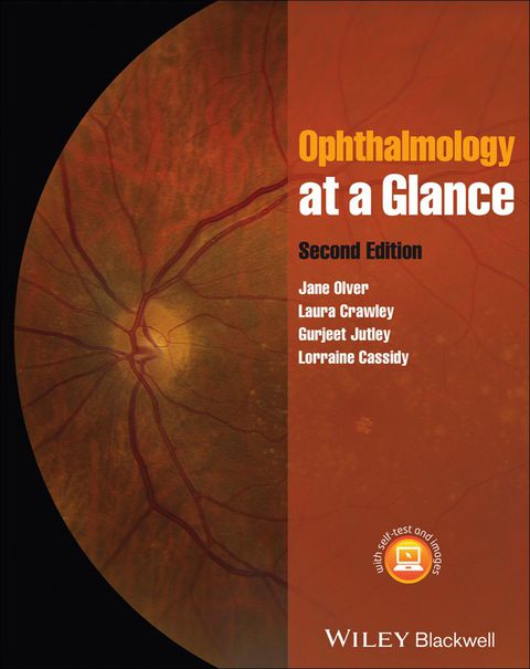 Ophthalmology at a Glance