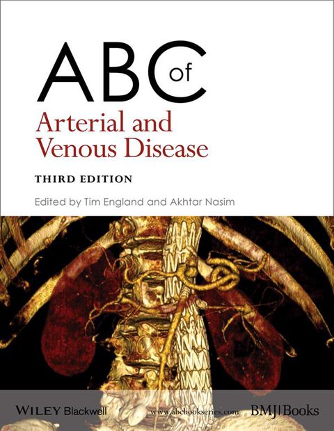 Abc of Arterial and Venous Disease