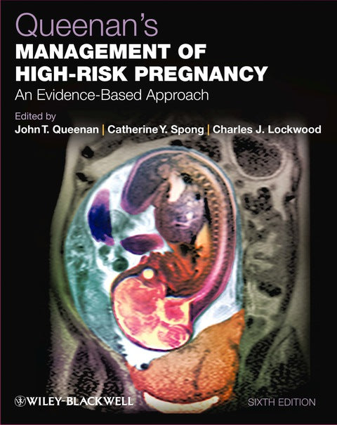 Queenans Management of High Risk Pregnancy an Evidence Based Approach