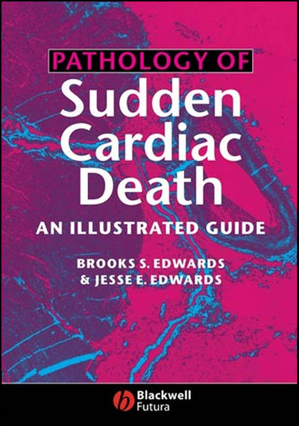 Pathology of Sudden Cardiac Death