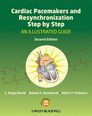 Cardiac Pacemakers and Resynchronization Step by Step an Illustrated Guide