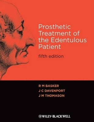 Prosthetic Treatment of the Edentulours Patient