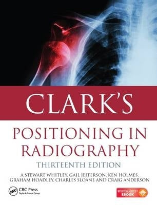 Clarks Positioning in Radiography