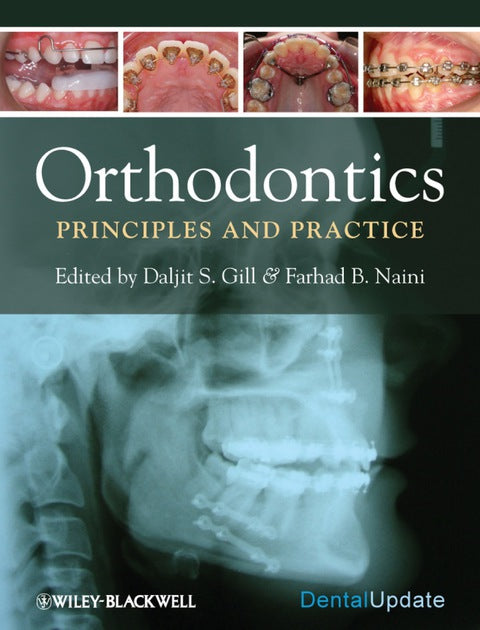 Orthodontics Principles and Practice