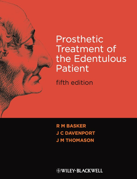 Prosthetic Treatment of the Edentulours Patient