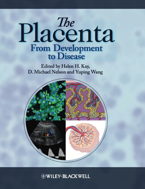 Placenta From Development to Disease