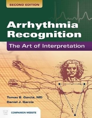 Arrhythmia Recognition the Art of Interpretation