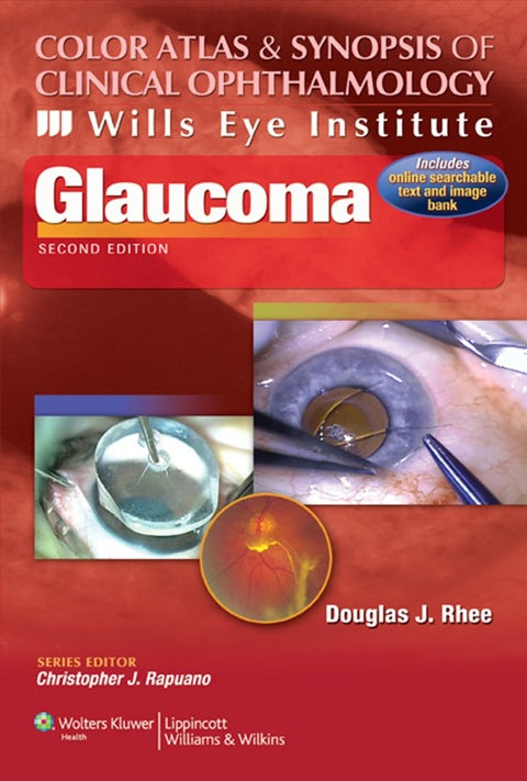 Color Atlas and Synopsis of Clinical Ophthalmology Wills Eye Institute Glaucoma
