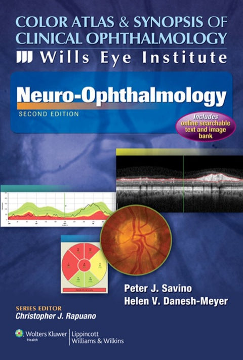 Color Atlas and Synopsis of Clinical Ophthalmology Retina
