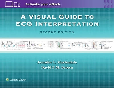Rapid Interpretation of Ecgs in Emergency Medicine a Visual Guide