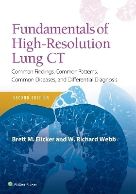 Fundamentals of High Resolution Lung Ct Common Findings Common Patterns Common Diseases
