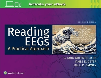 Reading Eegs a Practical Approach