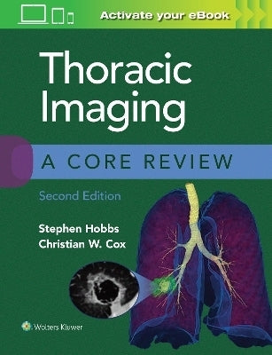 Thoracic Imaging a Core Review